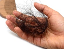 Восстановление утерянных волос в следствии сложных жизненных ситуаций
