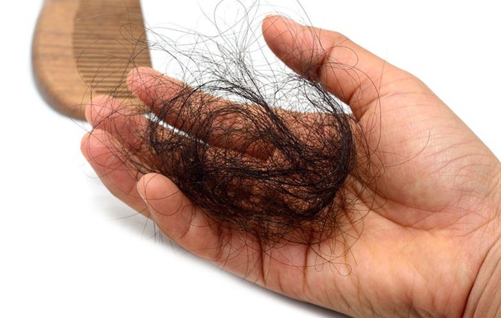 Восстановление утерянных волос в следствии сложных жизненных ситуаций