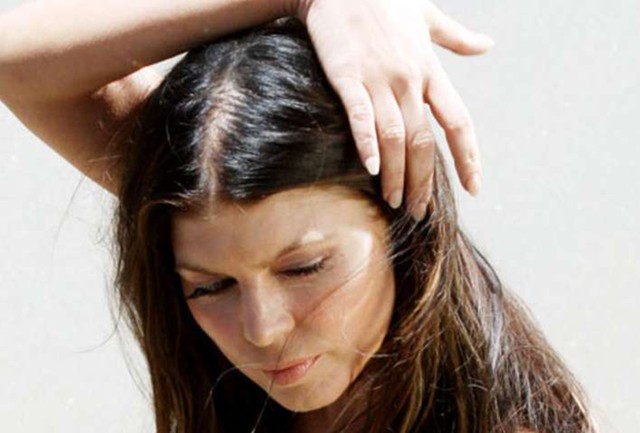 Дерматит кожи головы: причины, симптомы, лечение