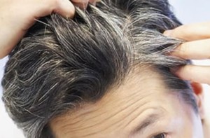 Перхоть — неприятное явление, портящее волосы
